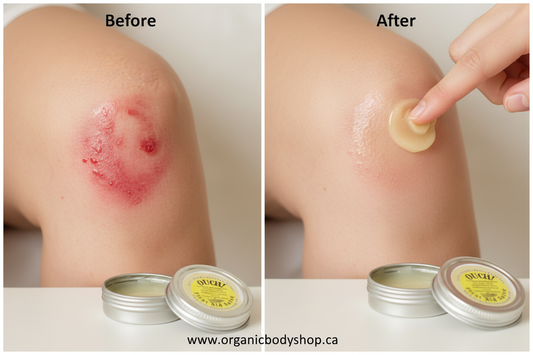 Before and after using Ouch First Aid Salve on a knee scrape